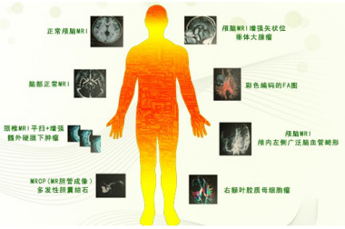 北京华坛中西医结合医院引入全球最新3.0T核磁共振
